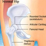 Normal Hip