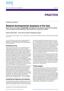 Bilateral developmental dysplasia of the hips